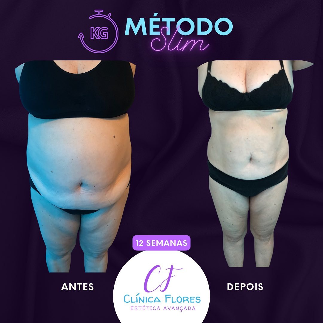 Método Slim — 12 Semanas